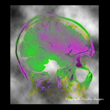 mindscape art gallery image